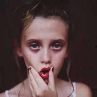 欧美皮肤斑点图片女,独特魅力与自信风采